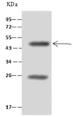 Immunoprecipitation: HNF-4 gamma/NR2A2 Antibody [NBP2-98899]