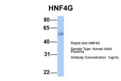 Western Blot: HNF-4 gamma/NR2A2 Antibody [NBP1-52810]