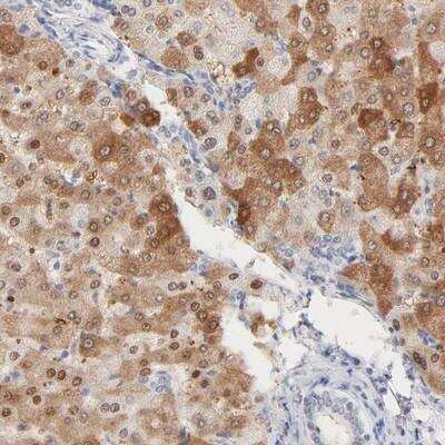 Immunohistochemistry: HNF-6/ONECUT1 Antibody [NBP1-91998]