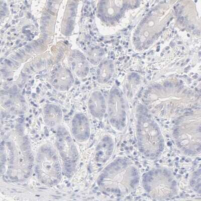 Immunohistochemistry-Paraffin: HNF-6/ONECUT1 Antibody [NBP1-91998]