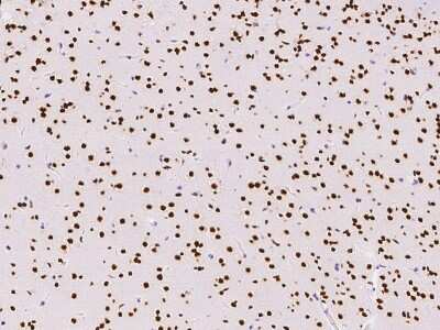 Immunohistochemistry-Paraffin: HNF-6/ONECUT1 Antibody [NBP2-99314]