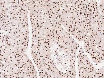 Immunohistochemistry-Paraffin: HNF-6/ONECUT1 Antibody [NBP2-99314]