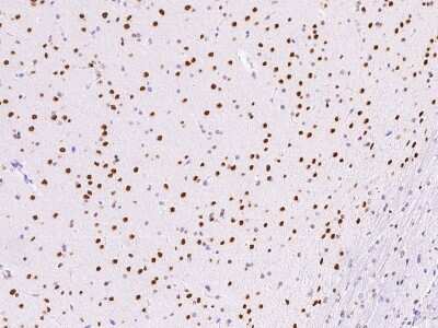 Immunohistochemistry-Paraffin: HNF-6/ONECUT1 Antibody [NBP2-99314]