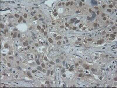 Immunohistochemistry: HNF-6/ONECUT1 Antibody (OTI4F12) - Azide and BSA Free [NBP2-70906]