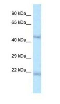 Western Blot: HNF-6/ONECUT1 Antibody [NBP1-91607]