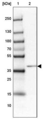 Western Blot: HNF-6/ONECUT1 Antibody [NBP1-91998]