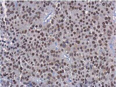 Immunohistochemistry-Paraffin: HNF1 Antibody (4110) [NBP2-43652]