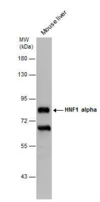 Western Blot: HNF1 Antibody (4110) [NBP2-43652]