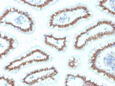 Immunohistochemistry-Paraffin: HNF1 Antibody (HNF1A/2087) - Azide and BSA Free [NBP2-79911]