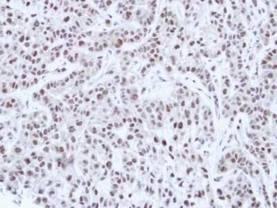 Immunohistochemistry-Paraffin: HNF1 Antibody [NBP1-33596]