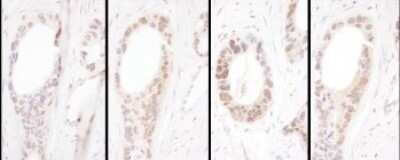 Immunohistochemistry-Paraffin: HNF1 Antibody [NBP2-32126]