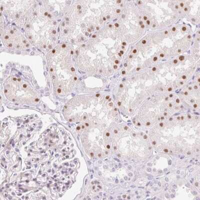 Immunohistochemistry-Paraffin: HNF1 Antibody [NBP2-38243]