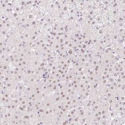Immunohistochemistry-Paraffin: HNF1 Antibody [NBP2-38243]