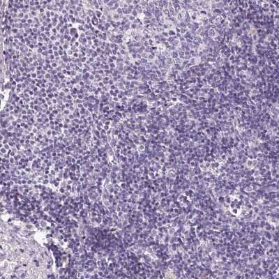 Immunohistochemistry-Paraffin: HNF1 Antibody [NBP2-38243]