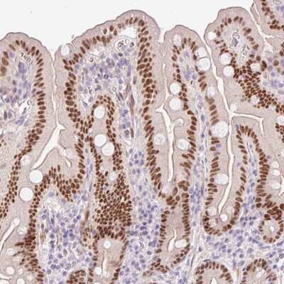 Immunohistochemistry-Paraffin: HNF1 Antibody [NBP2-38243]