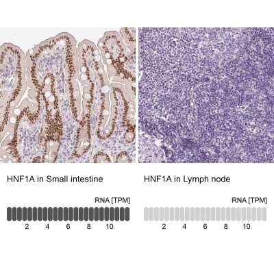 Immunohistochemistry-Paraffin: HNF1 Antibody [NBP2-38243]