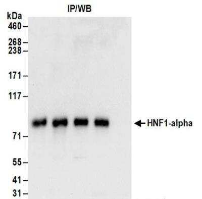 Immunoprecipitation: HNF1 Antibody [NBP2-32125]