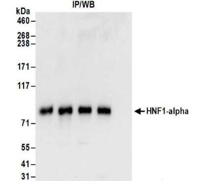 Immunoprecipitation: HNF1 Antibody [NBP2-32126]