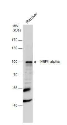 Western Blot: HNF1 Antibody [NBP1-33596]
