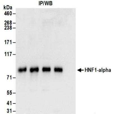 Western Blot: HNF1 Antibody [NBP2-32123]