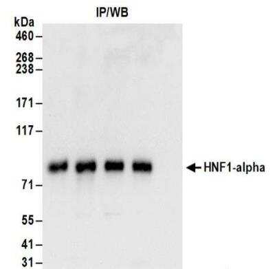 Western Blot: HNF1 Antibody [NBP2-32124]