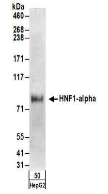 Western Blot: HNF1 Antibody [NBP2-32125]