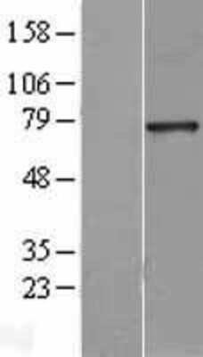 Western Blot: HNF1 Overexpression Lysate [NBL1-11630]