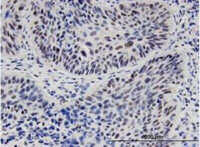 Immunohistochemistry-Paraffin: TCF-2/HNF-1 beta Antibody (4A1) [H00006928-M07]