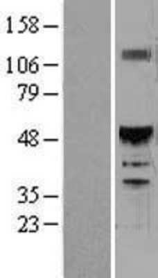 Western Blot: HNF-6/ONECUT1 Overexpression Lysate [NBL1-13936]