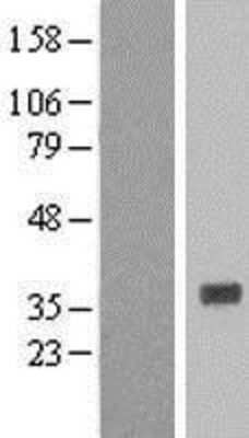 Western Blot: Histamine N-Methyltransferase/HNMT Overexpression Lysate [NBL1-11633]