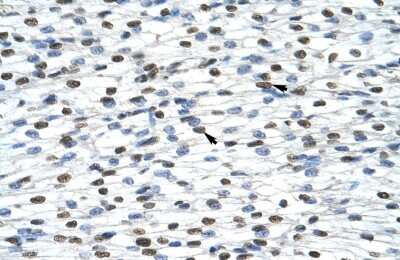 Immunohistochemistry-Paraffin: HNRNPA0 Antibody [NBP1-57275]