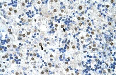 Immunohistochemistry-Paraffin: HNRNPA0 Antibody [NBP1-57275]