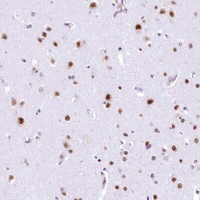 Immunohistochemistry-Paraffin: HNRNPA0 Antibody [NBP1-83240]