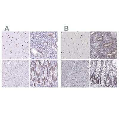 Immunohistochemistry-Paraffin: HNRNPA0 Antibody [NBP1-83240]
