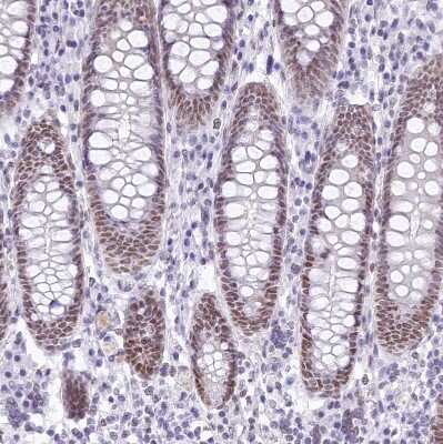 Immunohistochemistry-Paraffin: HNRNPA0 Antibody [NBP1-83240]