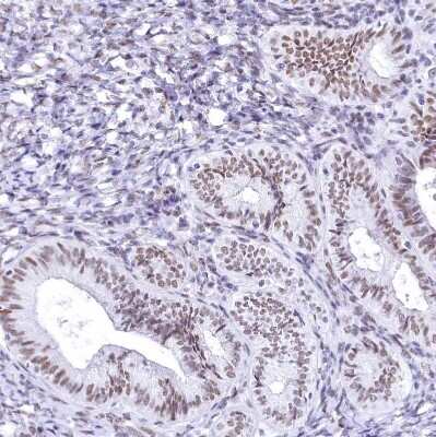 Immunohistochemistry-Paraffin: HNRNPA0 Antibody [NBP1-83240]
