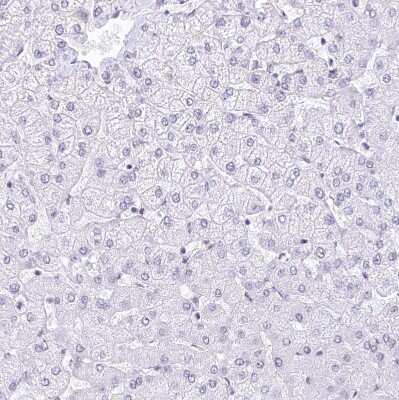 Immunohistochemistry-Paraffin: HNRNPA0 Antibody [NBP1-83240]