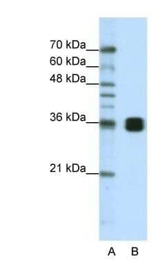 Western Blot: HNRNPA0 Antibody [NBP1-57275]