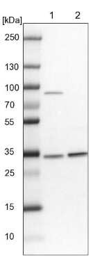 Western Blot: HNRNPA0 Antibody [NBP1-83240]