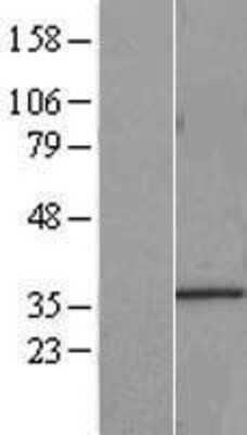 Western Blot: HNRNPA0 Overexpression Lysate [NBL1-11634]