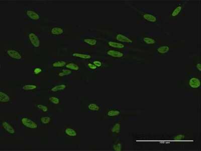 Immunocytochemistry/ Immunofluorescence: HNRNPUL1 Antibody [H00011100-B01P]