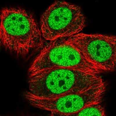 Immunocytochemistry/ Immunofluorescence: HNRNPUL1 Antibody [NBP2-47431]