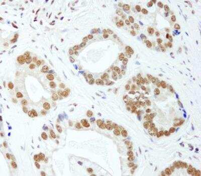 Immunohistochemistry-Paraffin: HNRNPUL1 Antibody [NB110-40587]