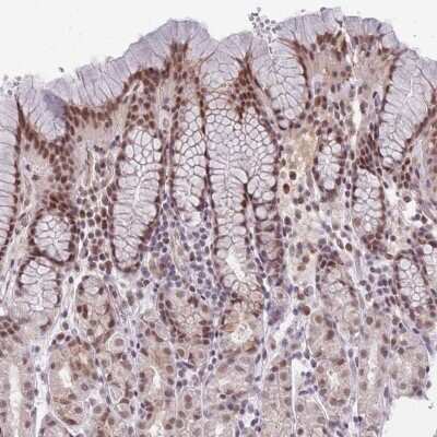 Immunohistochemistry-Paraffin: HNRNPUL1 Antibody [NBP2-47431]