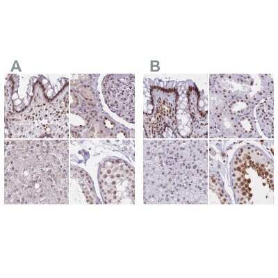 Immunohistochemistry-Paraffin: HNRNPUL1 Antibody [NBP2-47431]