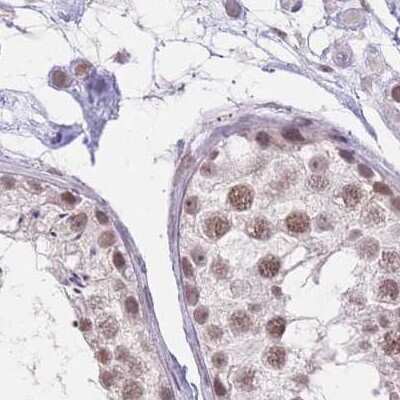 Immunohistochemistry-Paraffin: HNRNPUL1 Antibody [NBP2-47431]