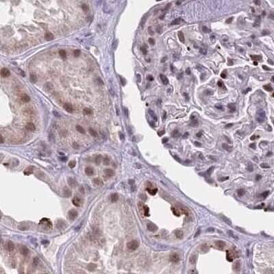 Immunohistochemistry-Paraffin: HNRNPUL1 Antibody [NBP2-47431]