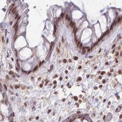 Immunohistochemistry-Paraffin: HNRNPUL1 Antibody [NBP2-47431]