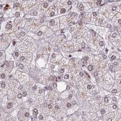 Immunohistochemistry-Paraffin: HNRNPUL1 Antibody [NBP2-47431]