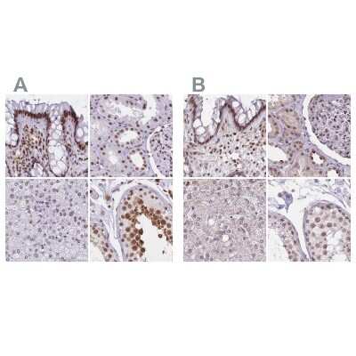 Immunohistochemistry-Paraffin: HNRNPUL1 Antibody [NBP2-47432]
